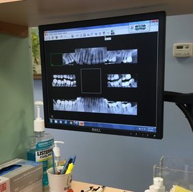 Dental x rays at Advanced Dental Technology of Ithaca II, PLLC